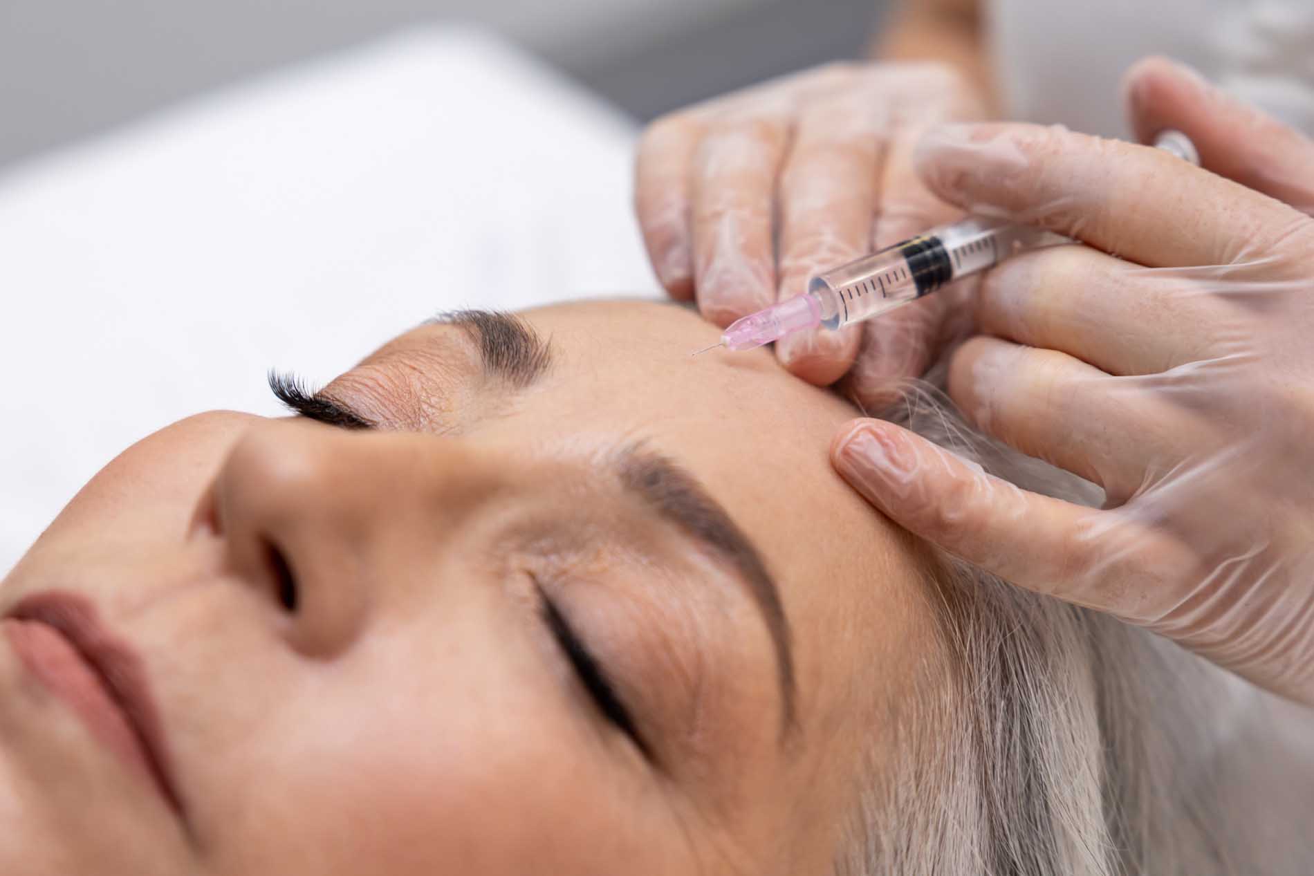 Neurotoxin injections BOTOX